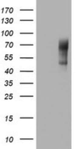 NUMB Mouse anti-Human, Clone: OTI2G1, lyophilized, TrueMAB 100 &mu;g; Unconjugated:Antibodies,