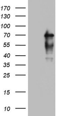 NUMB Mouse anti-Human, Clone: OTI1B5, lyophilized, TrueMAB 100 &mu;g; Unconjugated:Antibodies,
