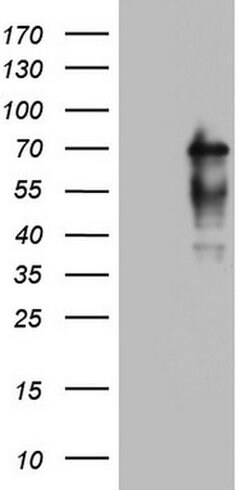 NUMB Monoclonal Antibody (OTI1B5), TrueMAB , OriGene 100 &mu;L; Unconjugated:Antibodies,