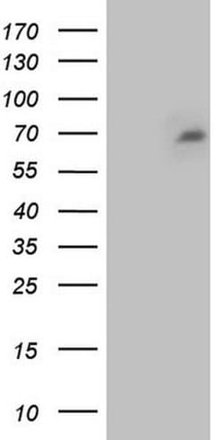 NUMB Monoclonal Antibody (OTI4C6), TrueMAB , OriGene 100 &mu;L | Buy Online | OriGene | Fisher Scientific