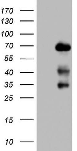 NUMB Monoclonal Antibody (OTI4D3), TrueMAB , OriGene:Antibodies:Primary