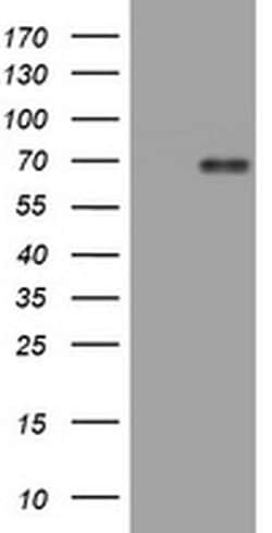 NUMB Monoclonal Antibody (OTI1A11), TrueMAB , OriGene 100 &mu;L; Unconjugated:Antibodies,