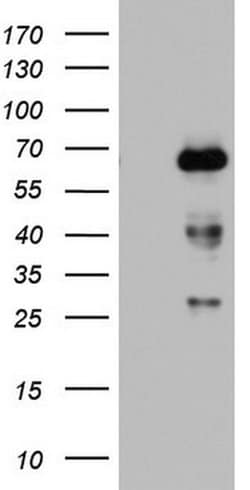 NUMB Monoclonal Antibody (OTI3H8), TrueMAB , OriGene 30 &mu;L; Unconjugated:Antibodies,