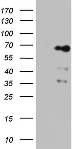 NUMB Monoclonal Antibody (OTI4H2), TrueMAB , OriGene 30 &mu;L | Buy Online | Origene Technologies | Fisher Scientific
