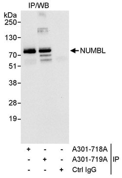 NUMBL Rabbit anti-Human, Polyclonal, Bethyl Laboratories 100 &mu;L; Unconjugated:Antibodies,