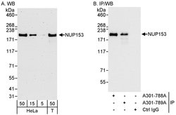 NUP153 Rabbit anti-Human, Polyclonal, Bethyl Laboratories 100 &mu;L; Unconjugated:Antibodies,