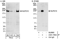 NUP210 Rabbit anti-Human, Polyclonal, Bethyl Laboratories 100 &mu;L; Unconjugated:Antibodies,