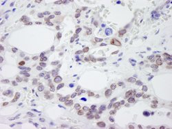 NUP214 Polyclonal Antibody, Bethyl Laboratories 100 &mu;L; Unconjugated:Antibodies,