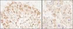 NUP50 Rabbit anti-Human, Mouse, Polyclonal, Bethyl Laboratories 100 &mu;L;