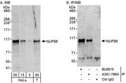 NUP98 Rabbit anti-Human, Polyclonal, Bethyl Laboratories 100 &mu;L; Unconjugated:Antibodies,