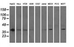 NXNL2 Monoclonal Antibody (OTI1C3), TrueMAB , OriGene 100 &mu;L; Unconjugated:Antibodies,