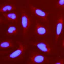 Invitrogen Nestin Monoclonal Antibody (10C2), Alexa Fluor 647 50 &mu;g;
