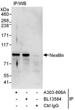 Nexilin Rabbit anti-Human, Polyclonal, Bethyl Laboratories 100 &mu;L | Buy Online | Bethyl Laboratories, Inc | Fisher Scientific