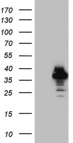 NKX3.1 Monoclonal Antibody (OTI1C11), TrueMAB , OriGene 30 &mu;L; Unconjugated:Antibodies,