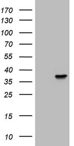 NKX3.1 Monoclonal Antibody (OTI4C11), TrueMAB , OriGene 30 &mu;L; Unconjugated:Antibodies,