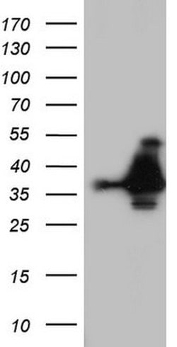 Nkx3.1 Mouse anti-Human, Clone: OTI1F5, lyophilized, TrueMAB 100 &mu;g;