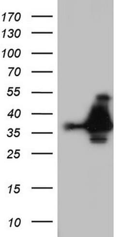 NKX3.1 Monoclonal Antibody (OTI1F5), TrueMAB , OriGene:Antibodies:Primary