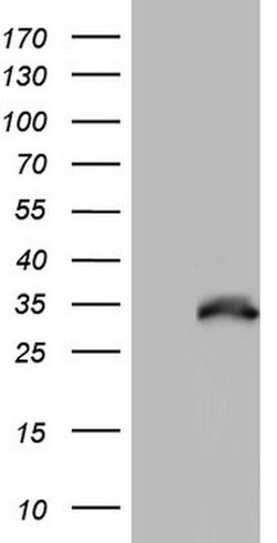 Nkx3.1 Mouse anti-Human, Clone: OTI2D2, lyophilized, TrueMAB 100 &mu;g;
