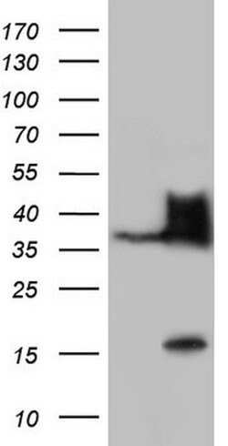 Nkx3.1 Mouse anti-Human, Clone: OTI2D11, lyophilized, TrueMAB 100 &mu;g;