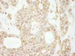 Notch1 Rabbit anti-Human, Polyclonal, Bethyl Laboratories 100 &mu;L; Unconjugated:Antibodies,