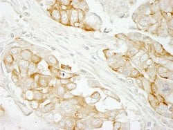 Notch2 Polyclonal Antibody, Bethyl Laboratories 10 &mu;L; Unconjugated:Antibodies,