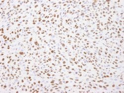 Nucleolin/NCL Polyclonal Antibody, Bethyl Laboratories 100 &mu;L; Unconjugated:Antibodies,