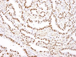 Nucleolin/NCL Polyclonal Antibody, Bethyl Laboratories 100 &mu;L; Unconjugated:Antibodies,