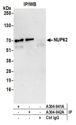 Nucleoporin p62/NUP62 Rabbit anti-Human, Polyclonal, Bethyl Laboratories