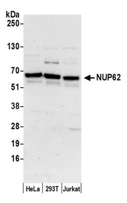 Nucleoporin p62/NUP62 Polyclonal Antibody, Bethyl Laboratories 20 &mu;l;