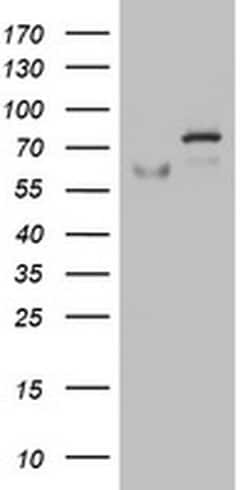 OAS2 Monoclonal Antibody (OTI4B11), TrueMAB , OriGene:Antibodies:Primary