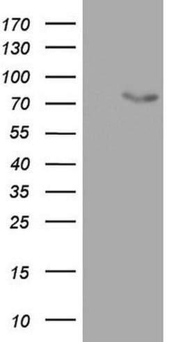 OAS2 Monoclonal Antibody (OTI2G3), TrueMAB , OriGene:Antibodies:Primary