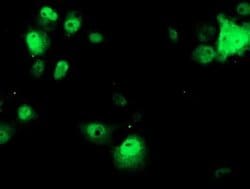 OBFC1 Monoclonal Antibody (OTI1C5), TrueMAB , OriGene 100 &mu;L; Unconjugated:Antibodies,