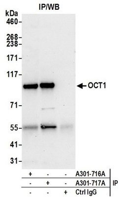 OCT1 Rabbit anti-Human, Polyclonal, Bethyl Laboratories 100 &mu;L; Unconjugated:Antibodies,