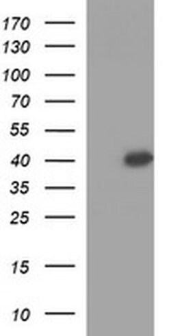 OCT4 Monoclonal Antibody (OTI2B6), TrueMAB , OriGene:Antibodies:Primary