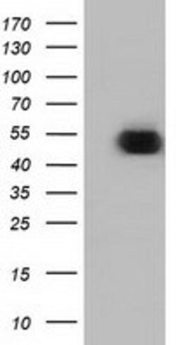 ODC1 Mouse anti-Human, Clone: OTI1G6, lyophilized, TrueMAB 100 &mu;g; Unconjugated:Antibodies,