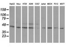 ODC1 Mouse anti-Human, Clone: OTI1G6, lyophilized, TrueMAB 100 &mu;g; Unconjugated:Antibodies,