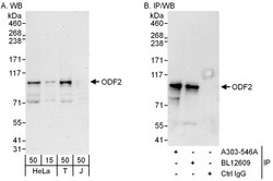 ODF2 Rabbit anti-Human, Polyclonal, Bethyl Laboratories 100 &mu;L; Unconjugated:Antibodies,