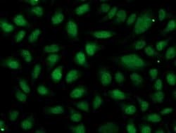 OGFOD1 Monoclonal Antibody (OTI1D9), TrueMAB , OriGene 30 &mu;L; Unconjugated:Antibodies,