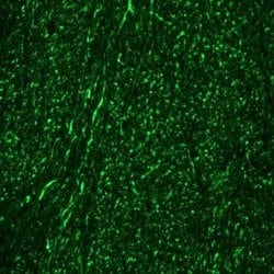Invitrogen NEFM Monoclonal Antibody (RNF 406) 100 &mu;L; Unconjugated:Antibodies,