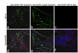 Invitrogen NF-H Monoclonal Antibody (RNF 402) 100 &mu;L; Unconjugated:Anticuerpos