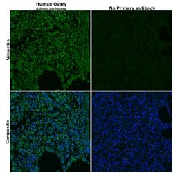 Invitrogen Vimentin Monoclonal Antibody (RV202) 100 &mu;L; Unconjugated:Antikörper