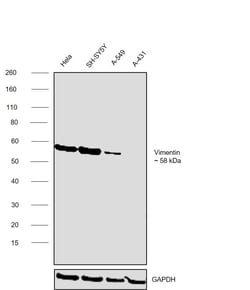 Invitrogen Vimentin Monoclonal Antibody (RV202) 100 &mu;L; Unconjugated:Antikörper
