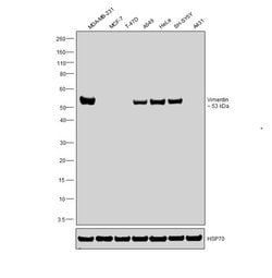 Invitrogen Vimentin Monoclonal Antibody (RV202) 100 &mu;L; Unconjugated:Antikörper