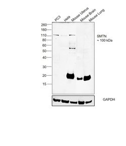 Invitrogen Smoothelin Monoclonal Antibody (R4A) 100 &mu;L; Unconjugated:Antibodies,