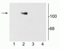 Invitrogen NMDAR1 Polyclonal Antibody 25 &mu;g; Unconjugated:Antibodies,
