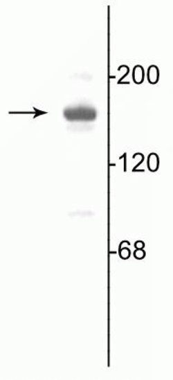 Invitrogen NMDAR2A Polyclonal Antibody 10 &mu;g | Buy Online | Invitrogen&trade; | Fisher Scientific