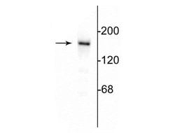 Invitrogen NMDAR2B Polyclonal Antibody 10 &mu;g; Unconjugated:Antibodies,