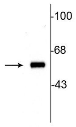 Invitrogen Tyrosine Hydroxylase Polyclonal Antibody 100 &mu;L | Buy Online | Invitrogen&trade; | Fisher Scientific