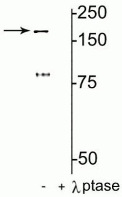 Invitrogen Phospho-NMDAR2B (Tyr1472) Polyclonal Antibody 100 &mu;L; Unconjugated:Antibodies,