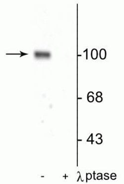 Invitrogen Phospho-GluR1 (Ser845) Polyclonal Antibody 150 &mu;L; Unconjugated:Antibodies,